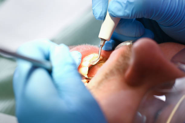 Best Emergency Dental Care for Broken or Chipped Teeth in Blair, WI